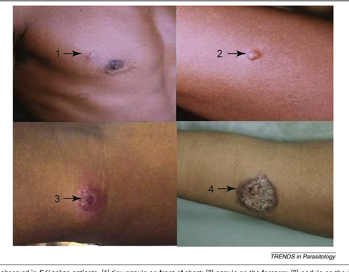 Glucantime Injection Price