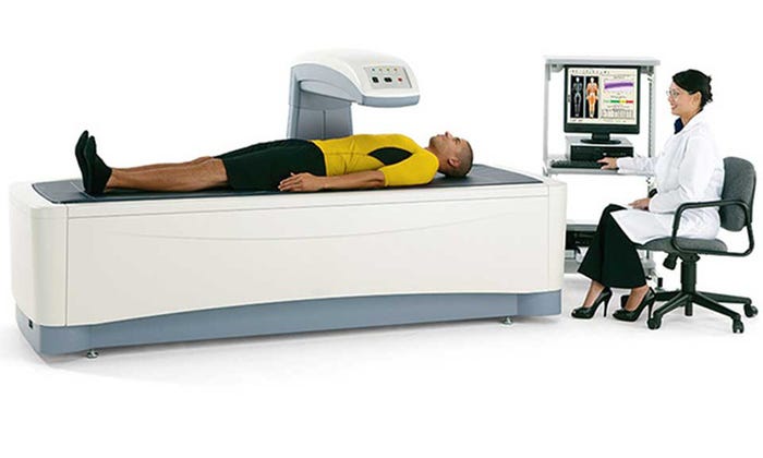 dexa scan