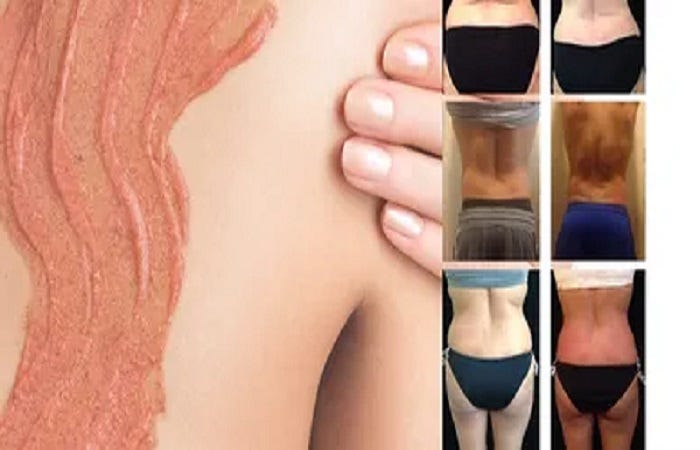 nonsurgical body sculpting