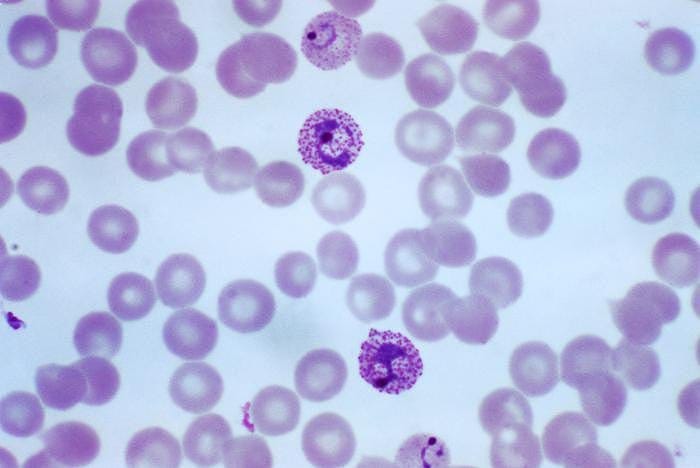 From Medellín to Tanzania: Building “BioTrust” to Democratize Pathogen Diagnostics with Edge AI