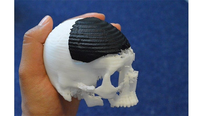 3D printed bone implants (staticflickr.com)