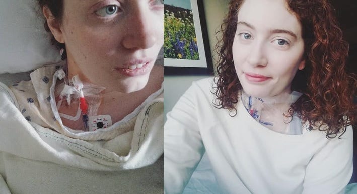 Two photos of the author with a neck port. One is taken lying down in a hospital bed, and one is in street clothes.