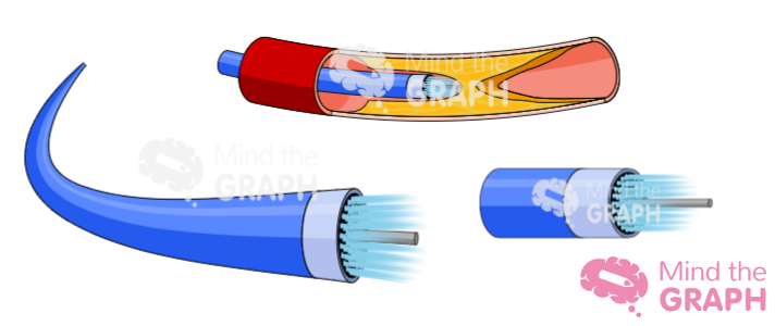 atherectomy