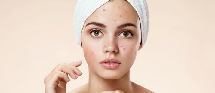home remedies for blemishes