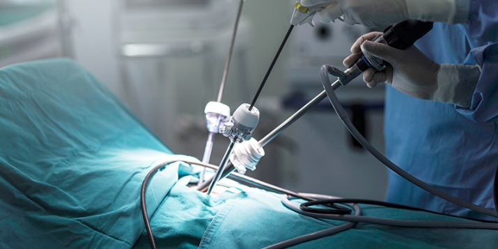 laparoscopic treatment in Noida