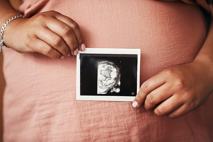 Closeup shot of an person holding a sonogram in front of their pregnant belly.