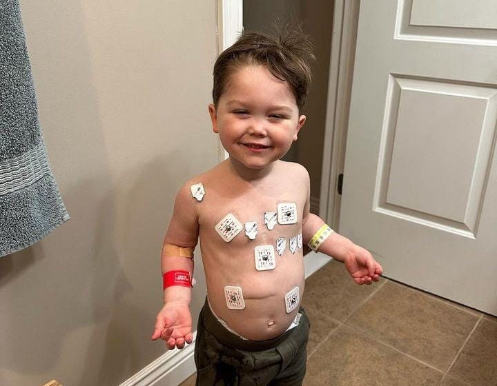 Toddler smiling with patches all over his chest