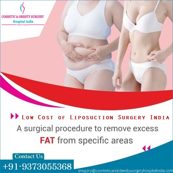 Liposuction In India