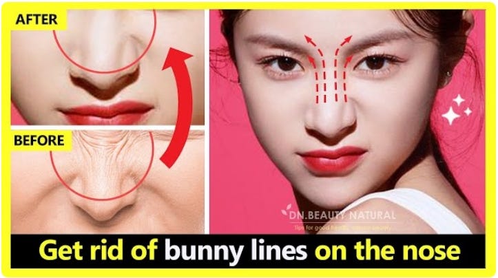 How To Get Rid Of Bunny Lines On The Nose Or Remove Nose Wrinkles Naturally