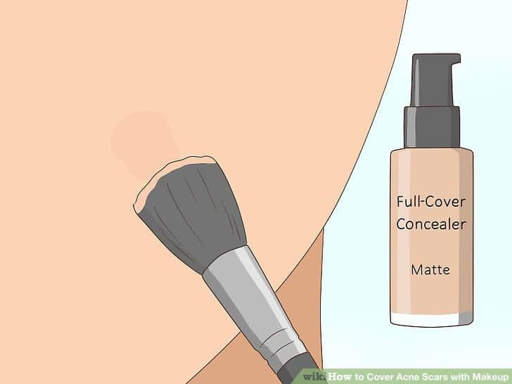 CONCEALING ACNE SCARS