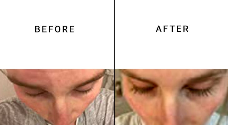 WooLash eyelash serum reviews before and after