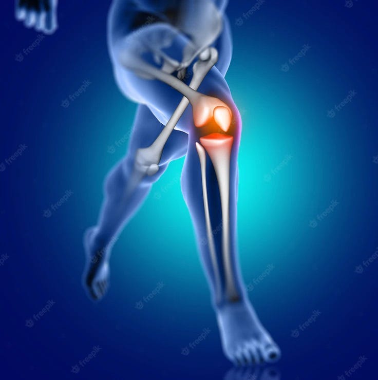 Partial knee arthroplasty