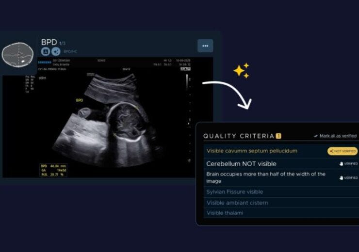 Samsung Medison’s Acquisition of Sonio: A Strategic Move in the Healthcare AI Market