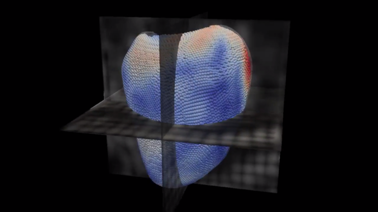 Lms 3d virtual heart