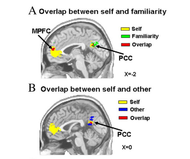 An fMRI of a brain when someone thinks of themself versus thinking of someone else