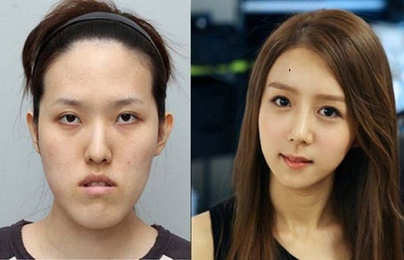 The Destructive Effects of South Korea's Beauty Standards, by Karin Cho, Invisible Illness