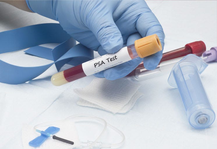 A Laboratory technician holding blood sample for PSA test.