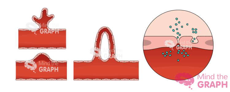 Angiogenesis