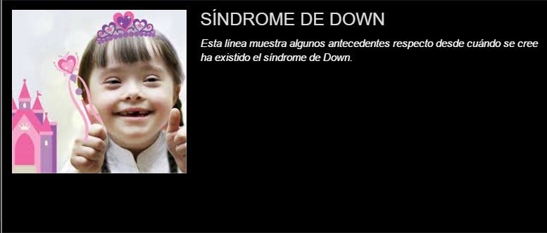 sindrome de down, que es el sindrome de down