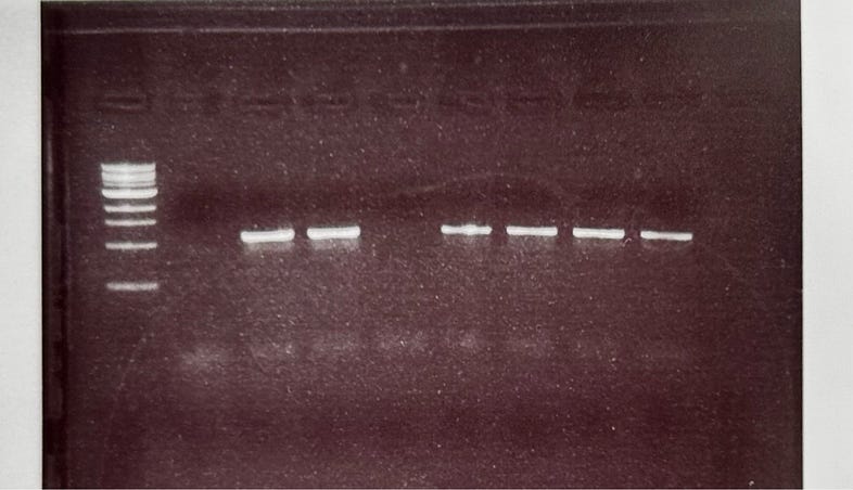 Fig 6. Results of my first DNA gel