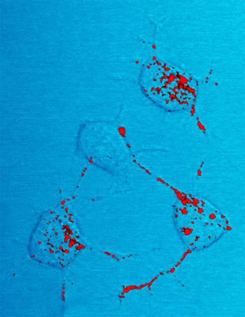 Prions infecting a mouse nerve cells traversing connecting fibers. The red dots are the prions.