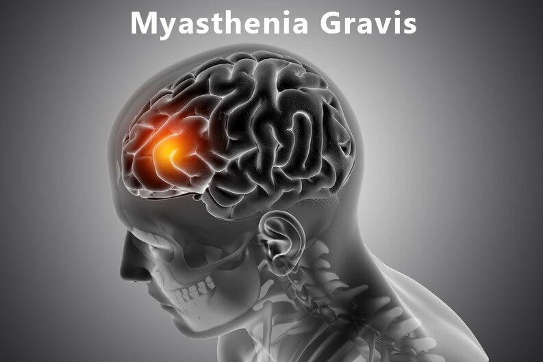 myasthenia gravis