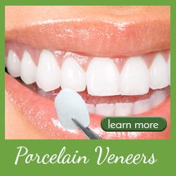 Porcelain Veneers Are Rising