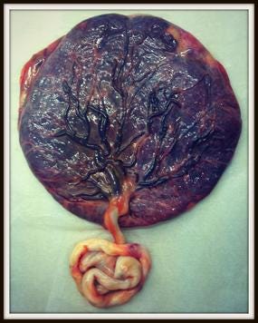 a placenta and umbilical chord