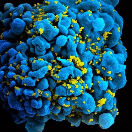 Science vs. Stigma: the Continued Criminalisation of HIV