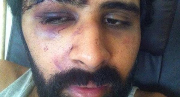 Beaten by a Malta White Taxi Driver