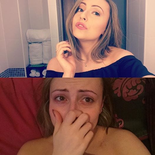 Before and after the anxiety started
