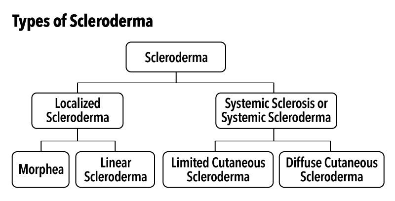 Scleroderma 