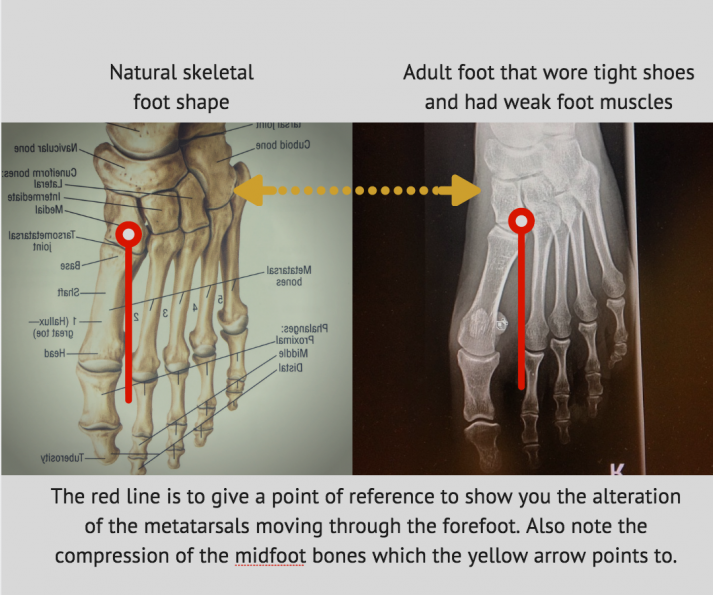 footchart