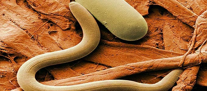 ascaridiasis