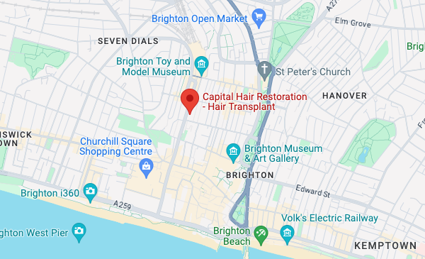 Capital Hair Restoration — Hair Transplant