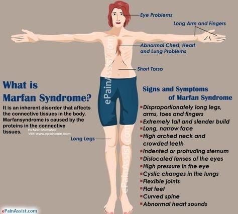 Marfan Syndrome 