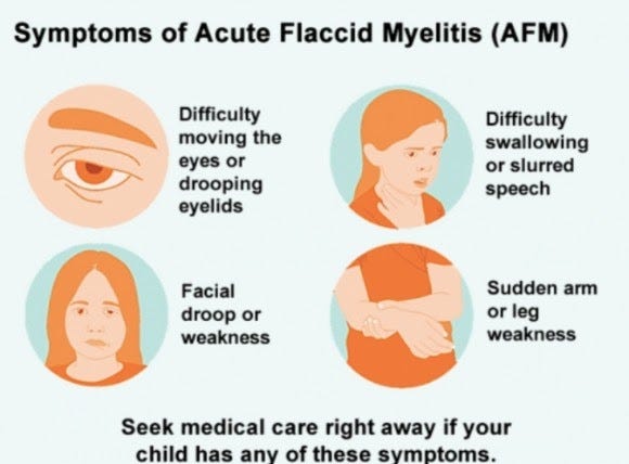 Acute Flaccid Myelitis 
