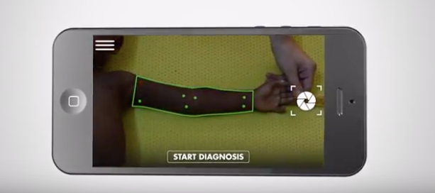 A phone depicts the Smart Diagnosis app.