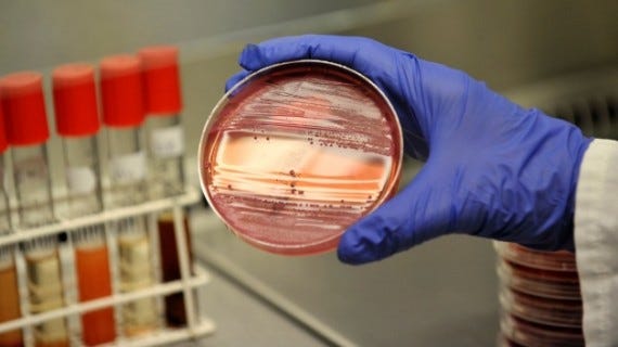 Everything You Need To Know About The So Called ‘sex Superbug
