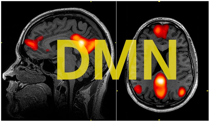 DMN default mode network psychedelics brain