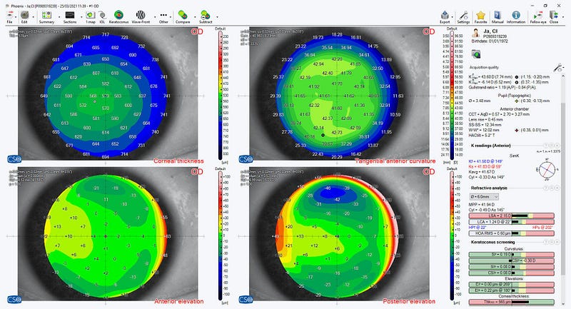 Applications of Sirius Test