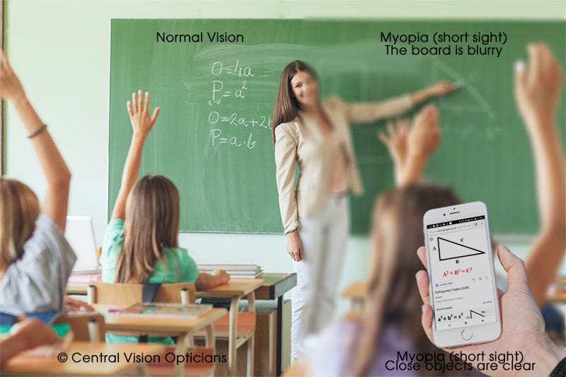 hyperopia-and-myopia-corrected-by-lens-concept-of-eyes-defect