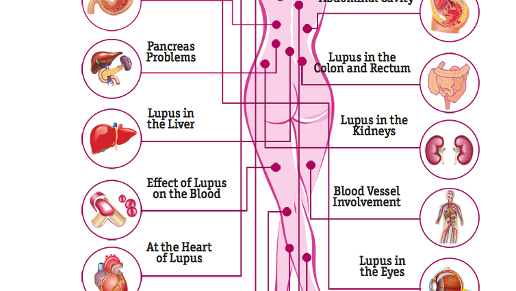 does lupus affect your organs