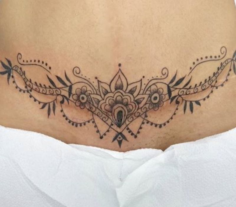Mandala Tummy Tuck Cover-up Tattoo