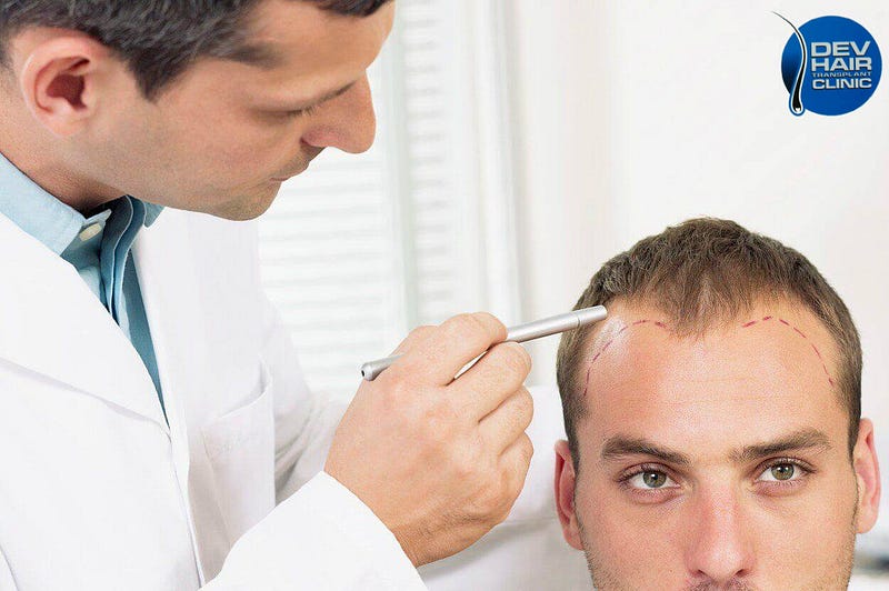 Hair transplant clinic in ahmedabad