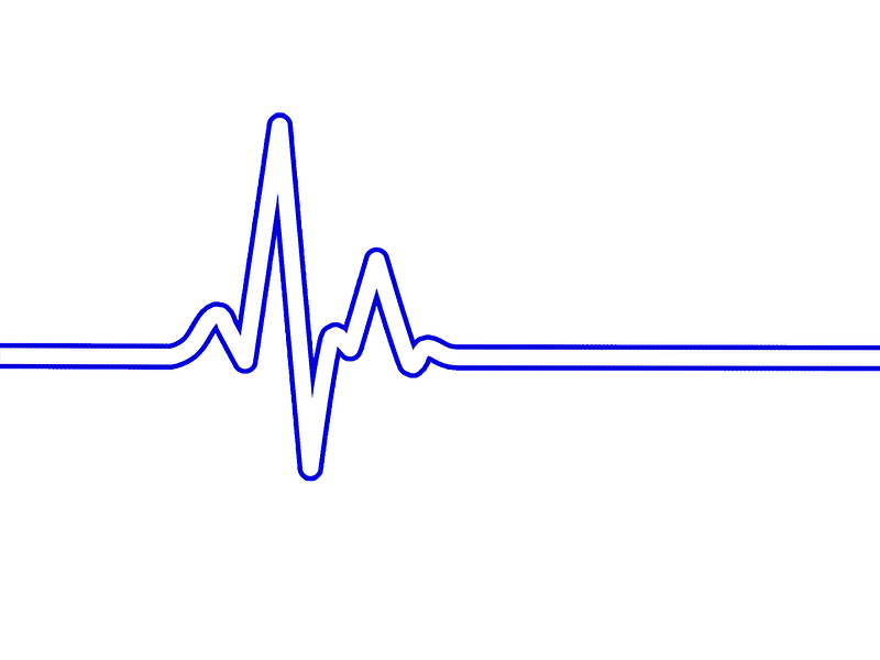 What’s your company’s resting heart rate?