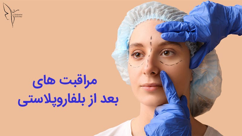 مراقبت‌های بعد از بلفاروپلاستی