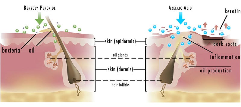 What Causes Keratin Buildup Wehelpcheapessaydownload web fc2