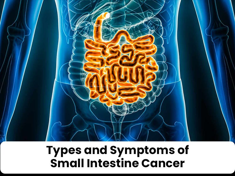 small intestine cancer symptoms