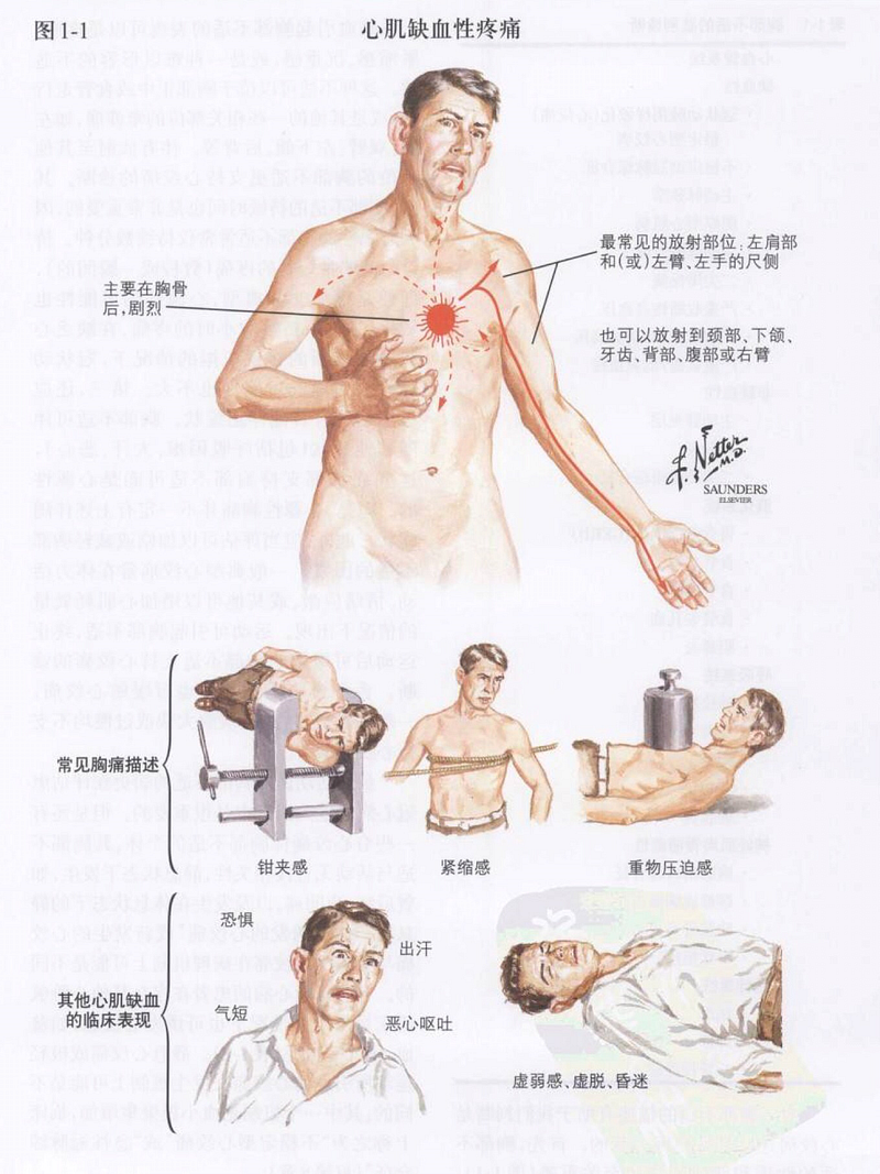 摘自《奈特心脏病学彩色图谱》